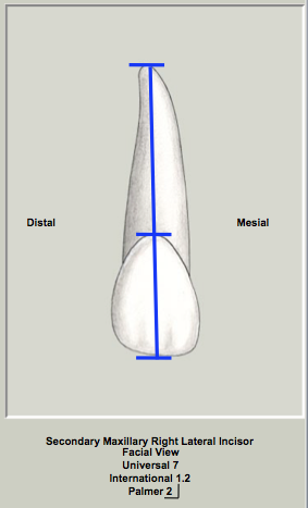 Mx Lateral Length Facial.png